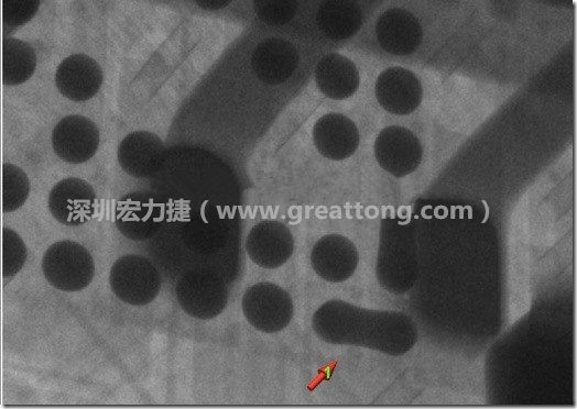 BGA因為焊墊變小，造成錫膏過多而最終形成焊接短路的結(jié)果。